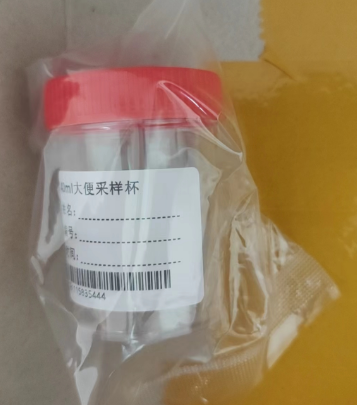 Laboratoriya müayinəsi üçün birdəfəlik nəcis toplayıcısı, nəcis nümunəsi şüşəsi, sterilizə olunmuş nəcis nümunəsi borusu 5/10/25/30ml