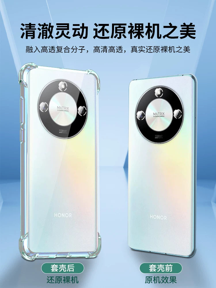 newyu Huawei Honor X70 cib telefonu qutusu x50x60 şəffaf üçün uyğundur